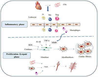 Progress of Single-Cell RNA Sequencing Technology in Myocardial Infarction Research